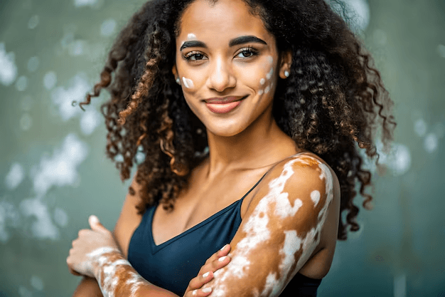 Makeup Tips for Vitiligo Skin Types: Protecting Your Skin from Pollution